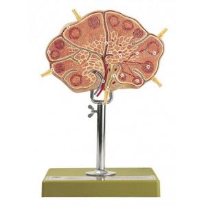 Ganglion lymphatique / SUR DEMANDE