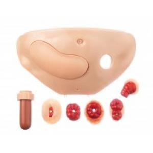 CLA 411/7 Abdominal cover with set of stomas and diabetis injection pad