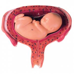 Utérus avec foetus dans le 5. mois