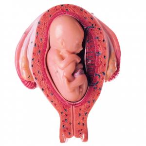 Utérus avec foetus dans le 5. mois