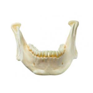 Maxillaire inférieur (mandibule)