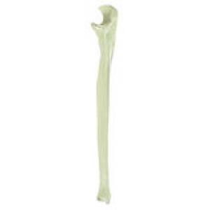 Cupitus