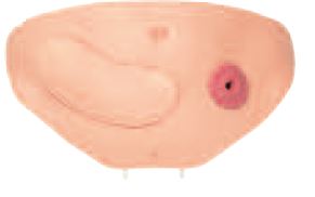 CLA 411 Abdominal cavity cover with colostomy