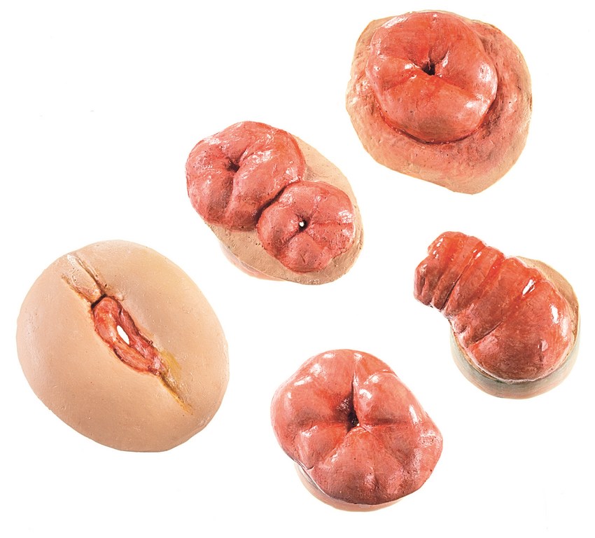 CLA 411 Abdominal cavity cover with colostomy