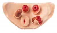 CLA 411/7 Abdominal cover with set of stomas and diabetis injection pad