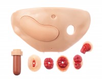 CLA 411 Abdominal cavity cover with colostomy